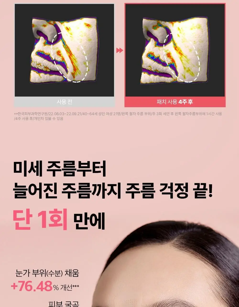 [집중주름패치] 더마펌 에이지 리바이빙 주름순삭패치 2종 택 1 (팔자6매+미간3매/팔자2매+미간1매) 상세페이지 21